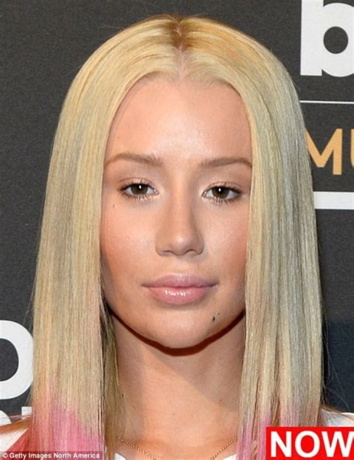 	Iggy Azalea recently had a nose job & chin implant, says an Iggy source	