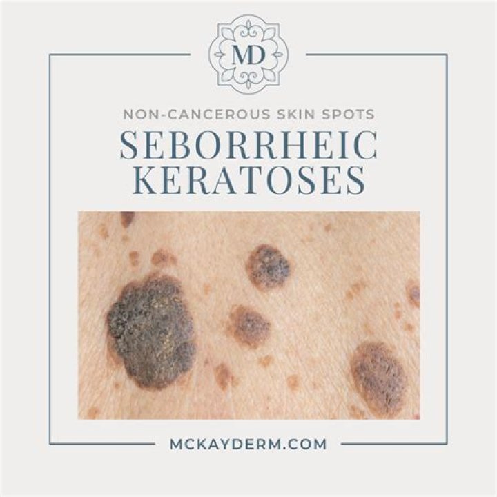 Seb Morris - Age, Family, Bio