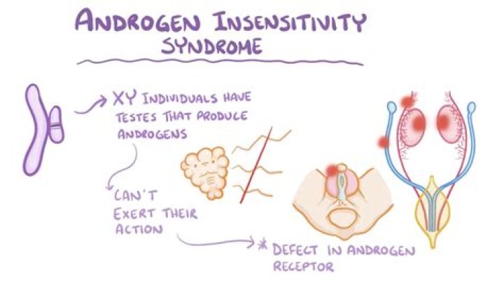 What causes AIS androgen insensitivity syndrome?