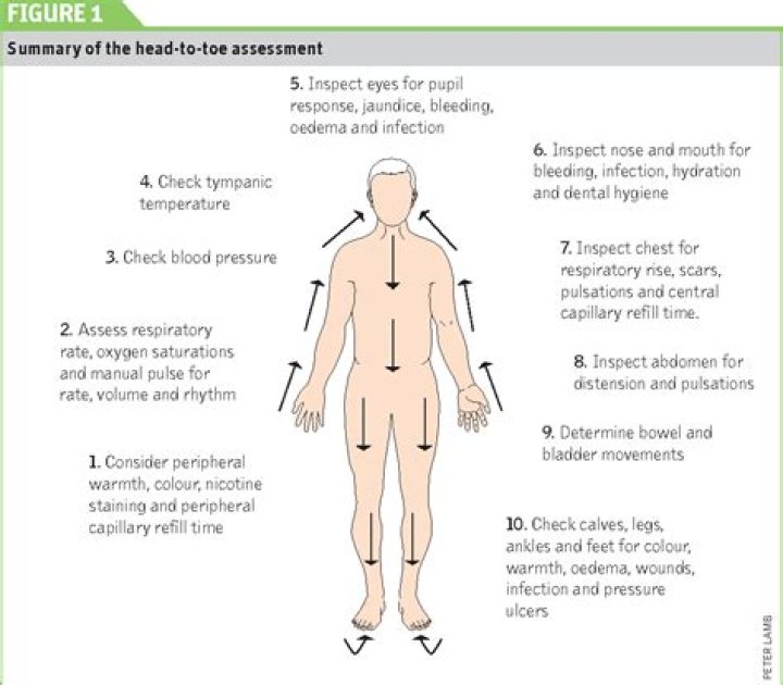 What does CSN stand for in medical terms?