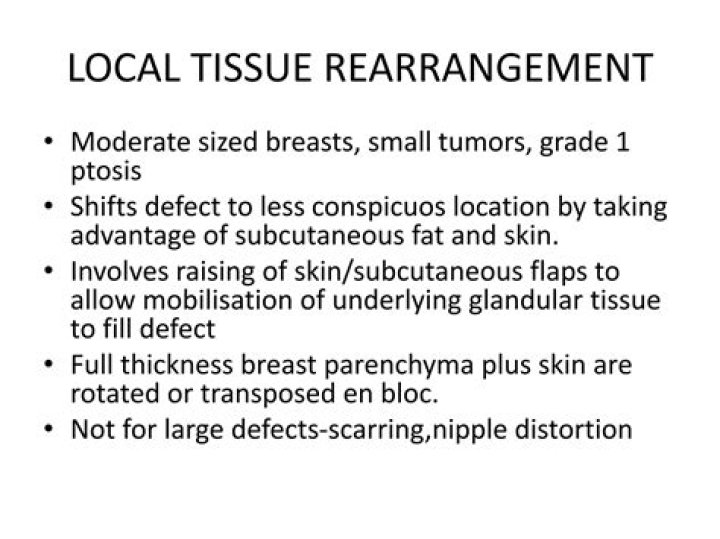 What is local tissue rearrangement?