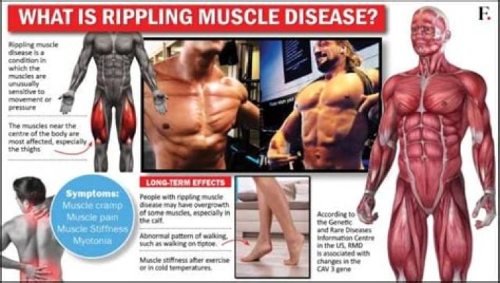 
What is rippling muscle disease? Jo Lindner’s rare condition explained as popular bodybuilder dies aged 30 