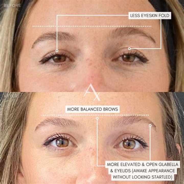 Whitney Buha raised some eyebrows with her Botox gone wrong video!